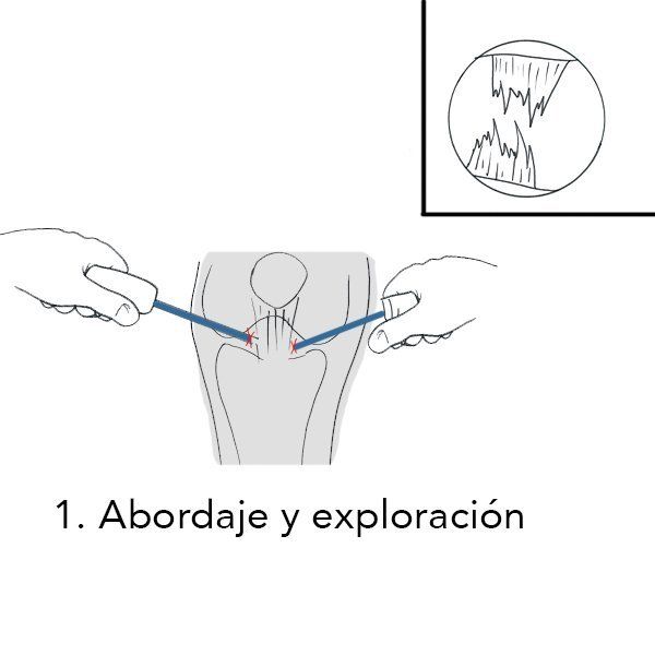 1.+Abordaje+y+exploración-1920w-2
